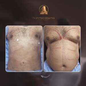 dr.ahmedlotfyy-٢٤-٠٥-٢٠٢٥-0096