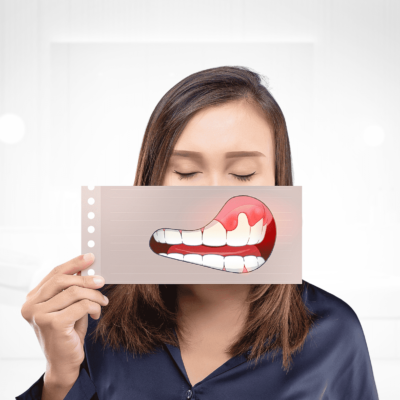 9. علاج أمراض اللثة