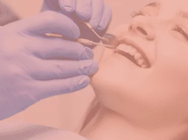 Dental Fillings