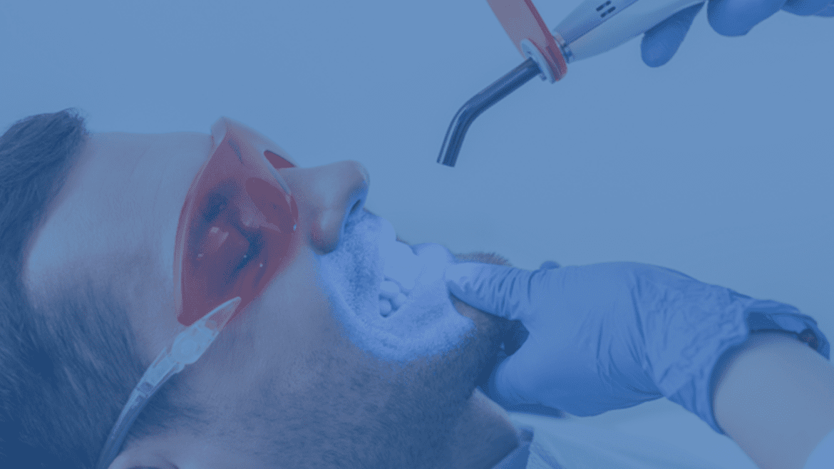 ليزر الأسنان