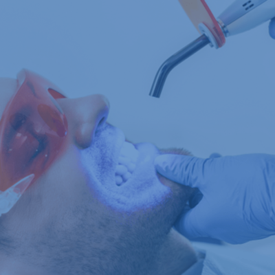 dental laser-min