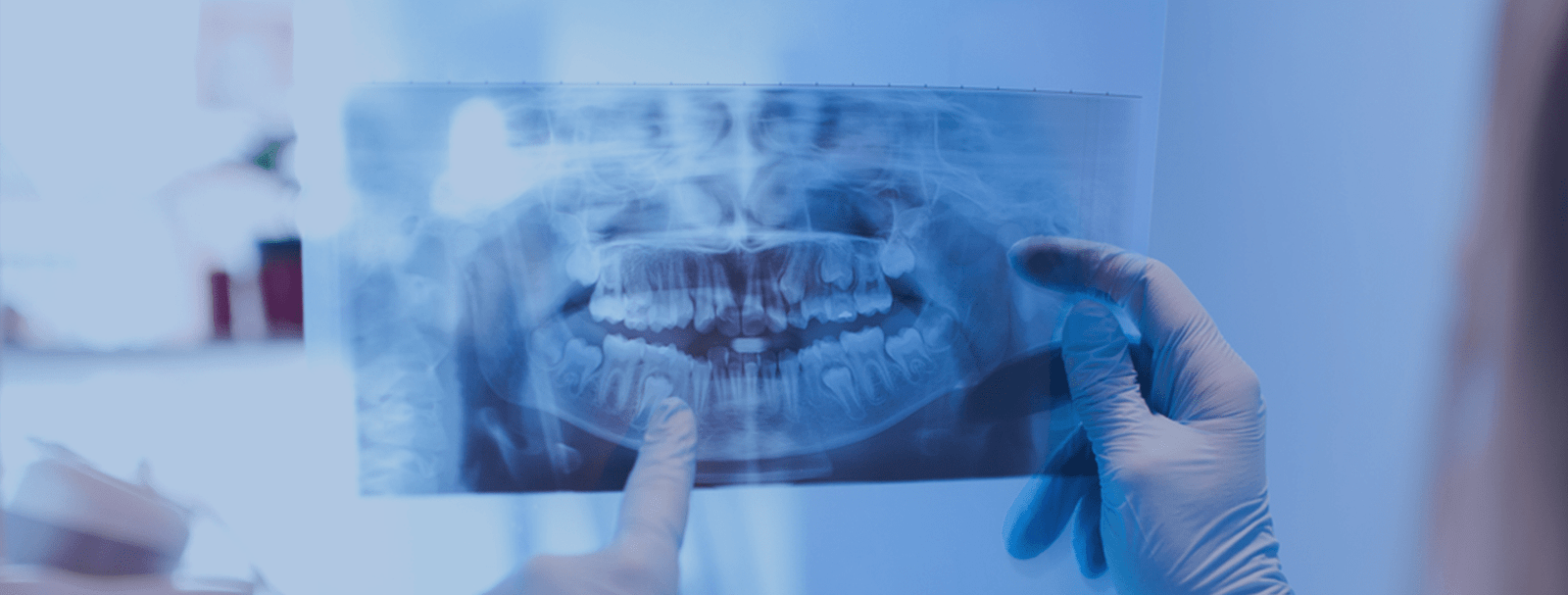 The 3D and the panoramic X-Rays