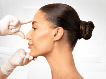 تجميل الأنف