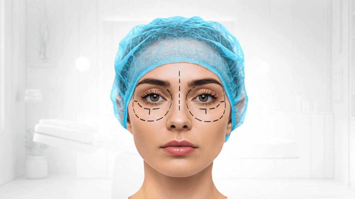 Eyelid Surgery (Blepharoplasty)