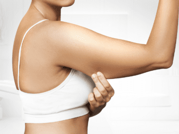 Brachioplasty (Arm Lift)