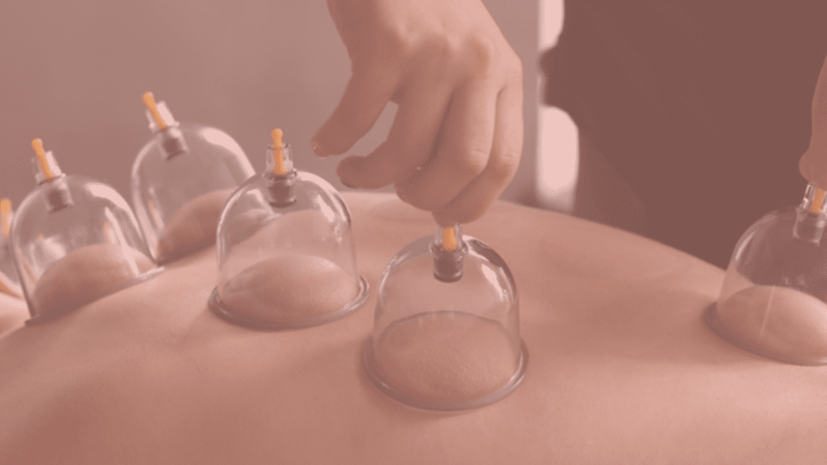 الحجامه الجافه والرطبه