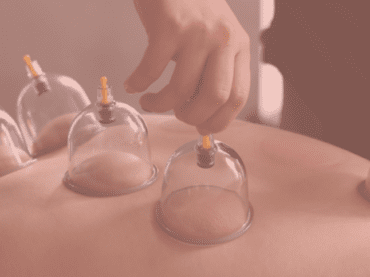 Dry and wet cupping
