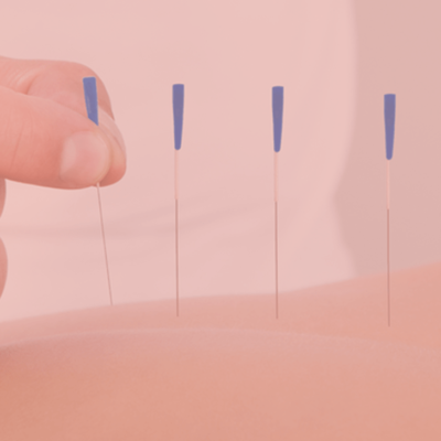 needling therapy copy-min