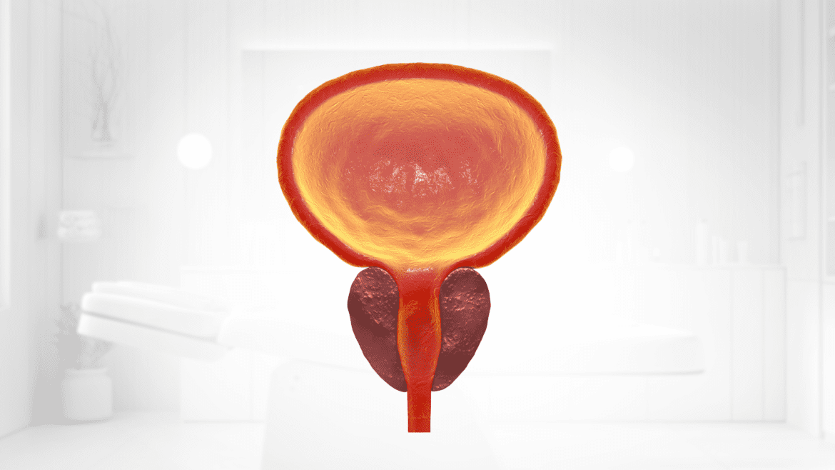 علاج تضخم البروستاتا الحميد