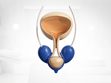 Laparoscopic prostate surgeries
