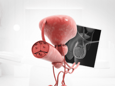 Comprehensive examination and assessment of infertility cases in men