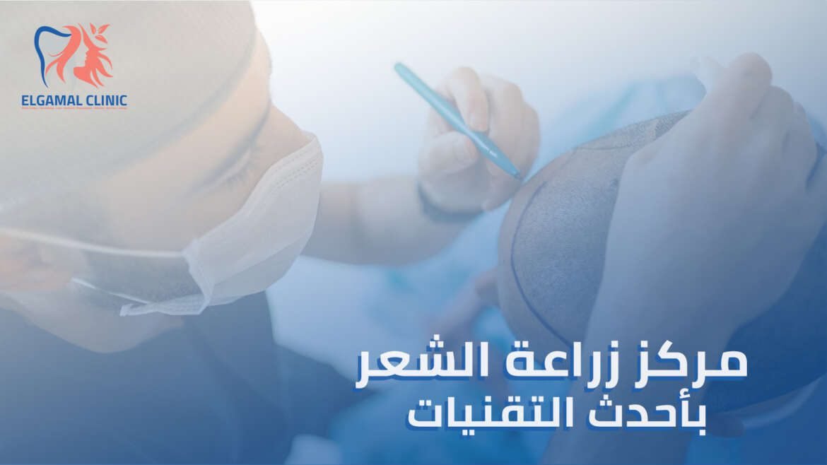 استعد لشعر أكثر كثافة مع أفضل مركز زراعة الشعر 