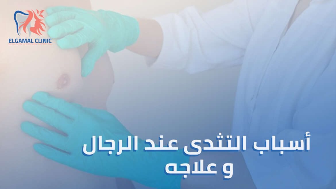 فهم التثدى عند الرجال وعلاجه: الأسباب، الأعراض، والعلاجات الفعالة