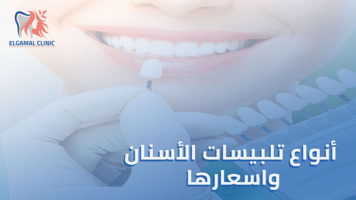أنواع تلبيسات الأسنان واسعارها: دليل شامل لتحسين مظهر أسنانك