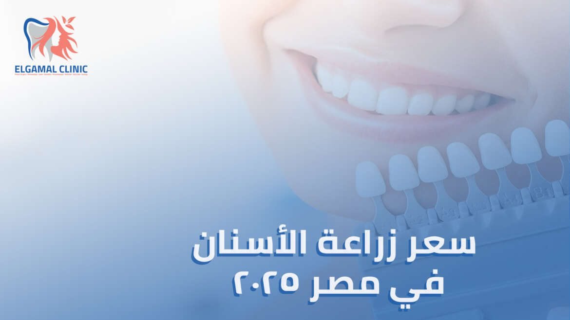 سعر زراعة الأسنان في مصر: أهم العوامل التي تحدد التكلفة النهائية