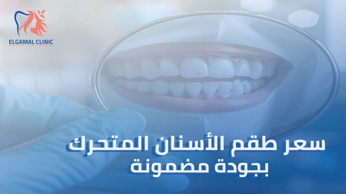 أهم عوامل تحديد سعر طقم الأسنان المتحرك في مصر 2025
