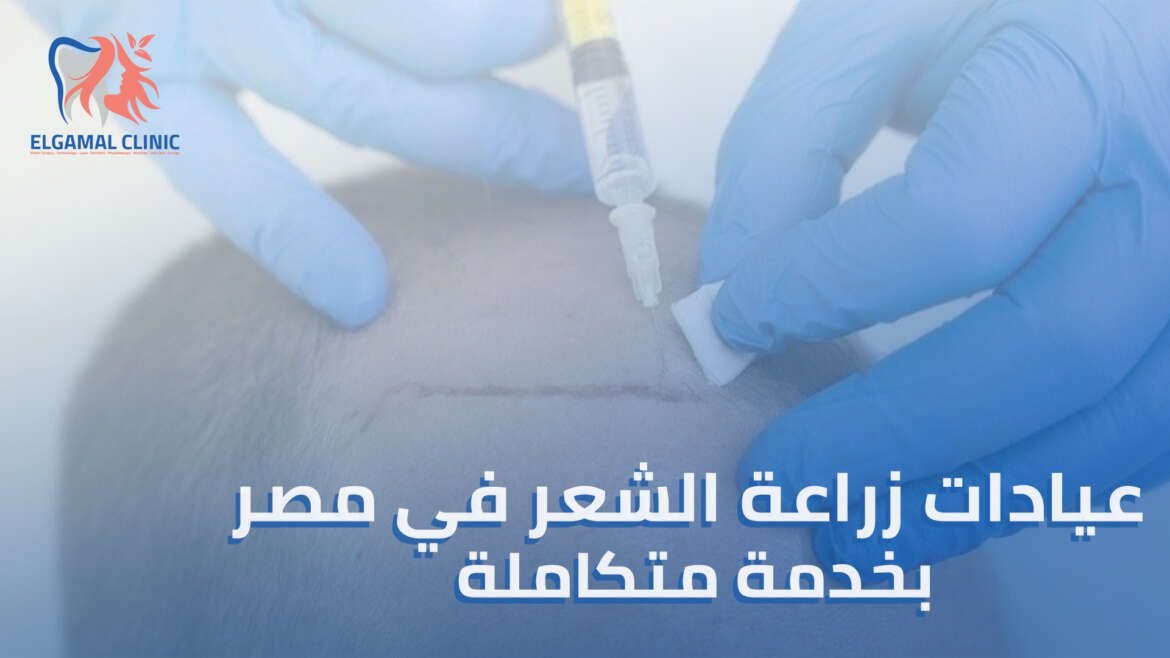 أفضل عيادات زراعة الشعر في مصر: دليلك لاختيار المركز المثالي لزراعة الشعر