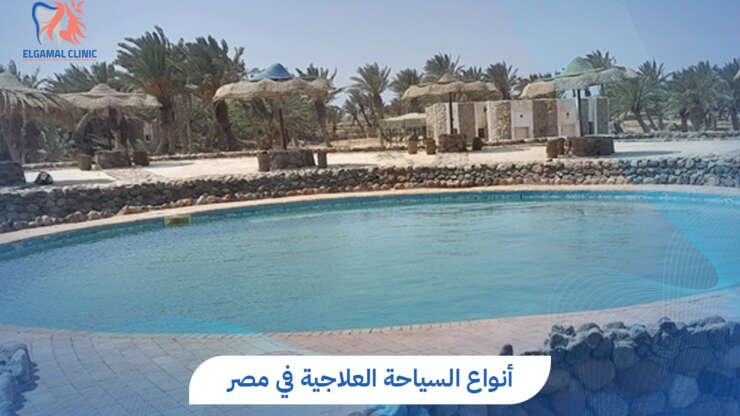 أنواع السياحة العلاجية: لماذا مصر من أفضل وجهات السياحة العلاجية؟ 