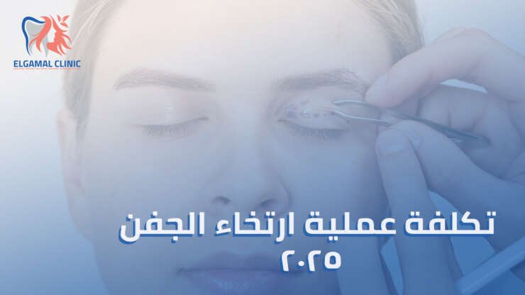تكلفة عملية ارتخاء الجفن: كل ما تحتاج معرفته عن طرق علاج ارتخاء الجفن