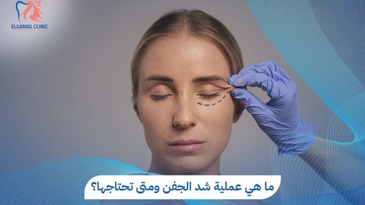 دليلك الشامل حول عملية شد الجفن في مصر