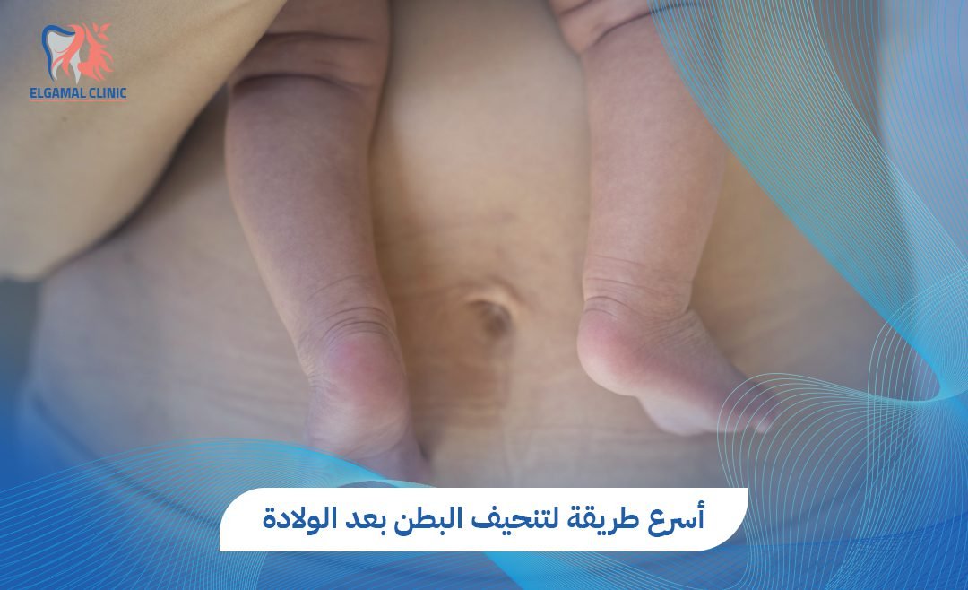 أسرع طريقة لتنحيف البطن بعد الولادة: خيارات علاجية متعددة 