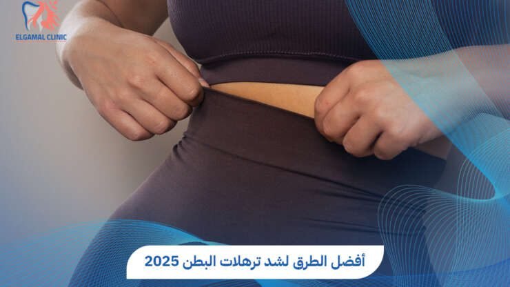 شد ترهلات البطن بعد الولادة القيصرية | أفضل دكتور تجميل في مصر