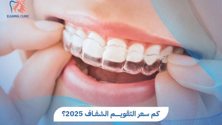 تعرف على سعر التقويم الشفاف في مصر 2025