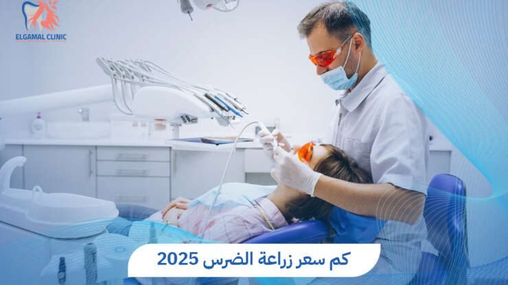 سعر زراعة الضرس في مصر: التكلفة والعوامل المؤثرة وخيارات العلاج