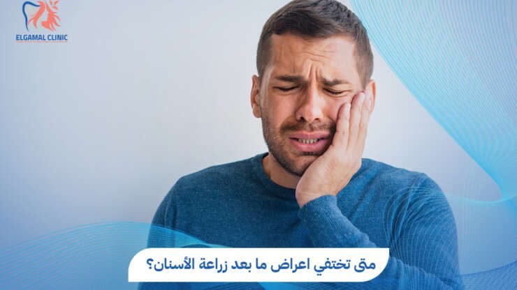 اعراض ما بعد زراعة الأسنان: كل ماتحتاج أن تعرفه عن العملية والرعاية بعد الزراعة