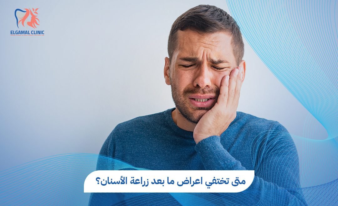 اعراض ما بعد زراعة الأسنان: كل ماتحتاج أن تعرفه عن العملية والرعاية بعد الزراعة