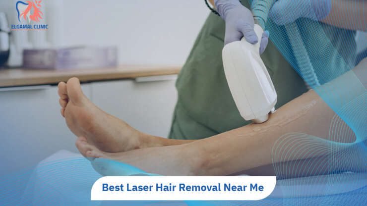 Laser Hair Removal | Cost, packages & Best in Cairo.