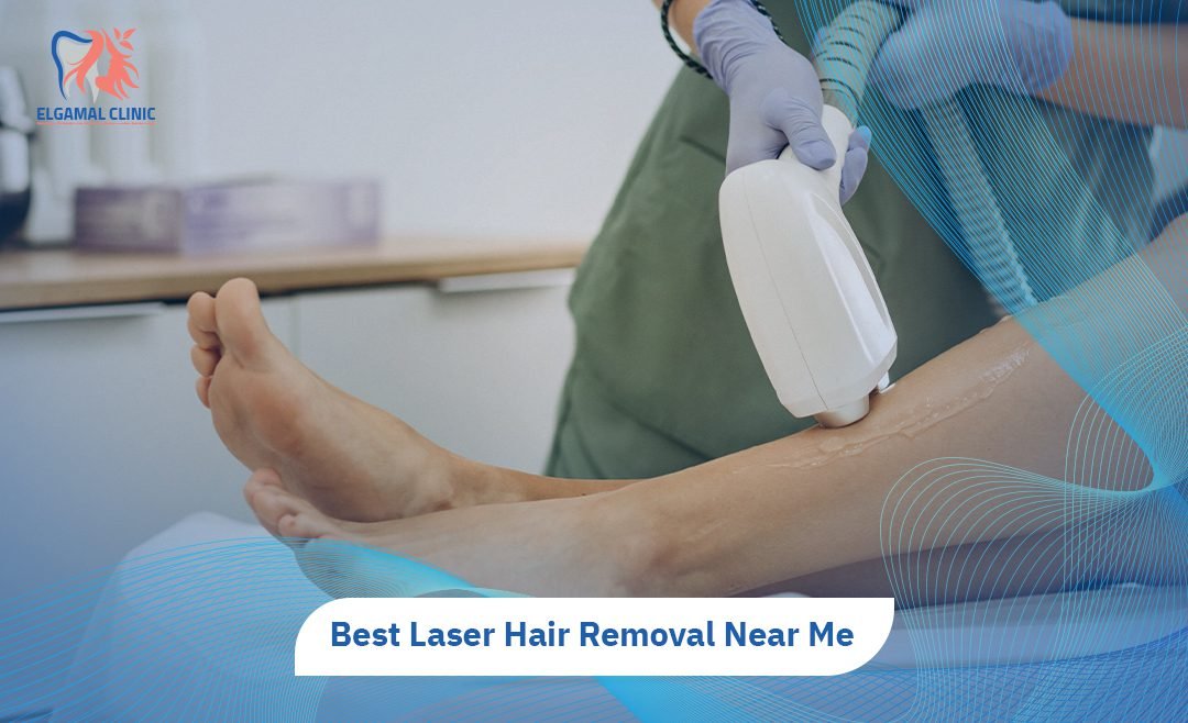 Laser Hair Removal | Cost, packages & Best in Cairo.