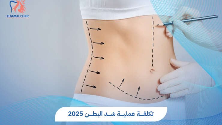 تكلفة عملية شد البطن في مصر 2025 | الأسعار والعوامل المؤثرة