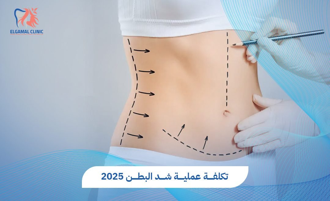 تكلفة عملية شد البطن في مصر 2025 | الأسعار والعوامل المؤثرة
