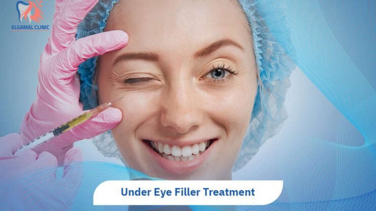 Under Eye Filler: Cost, Results & Safety in Cairo
