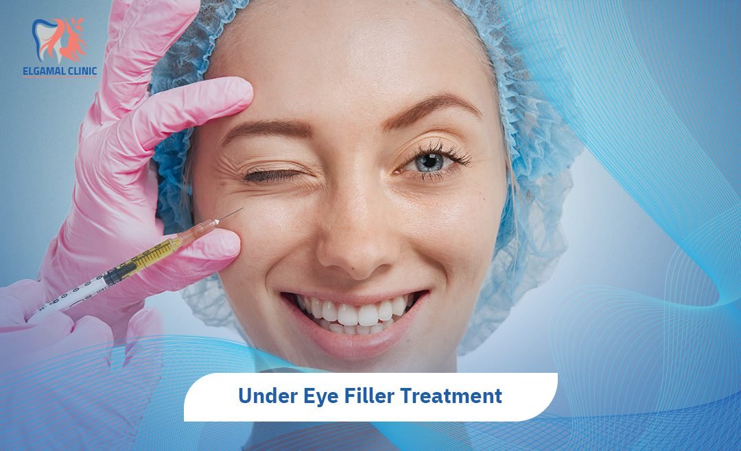 Under Eye Filler: Cost, Results & Safety in Cairo