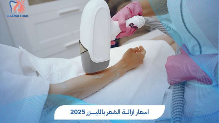 اسعار إزالة الشعر بالليزر في مصر 2025