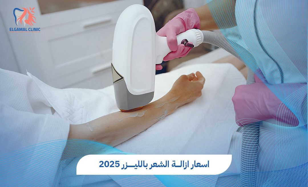 اسعار إزالة الشعر بالليزر في مصر 2025