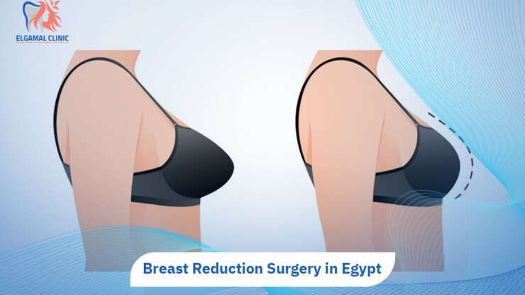 Breast Reduction Surgery in Egypt | El Gamal Clinics.
