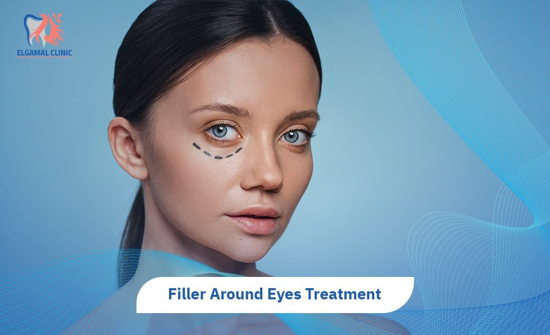 Filler Around Eyes: 3 Benefits for Brighter Eyes.