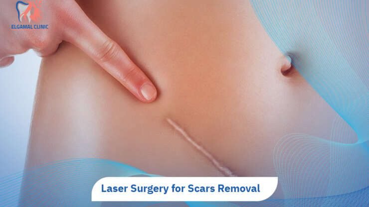 Laser Surgery for Scars: 5 Benefits & Treatments