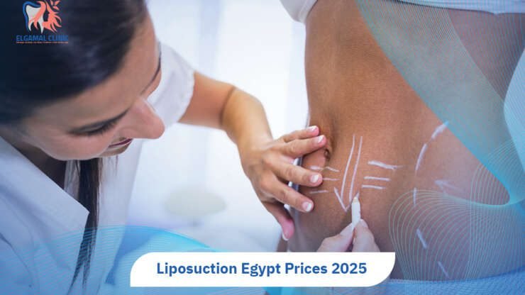 Liposuction Egypt Prices | Cost, Techniques & Expert Care.