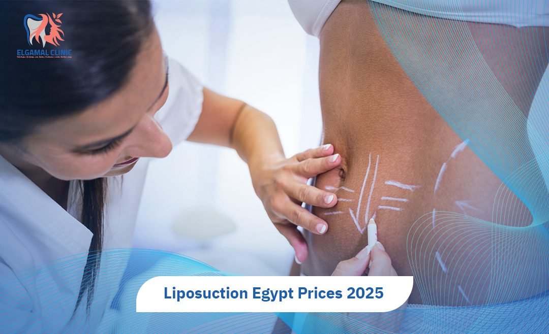 Liposuction Egypt Prices | Cost, Techniques & Expert Care.