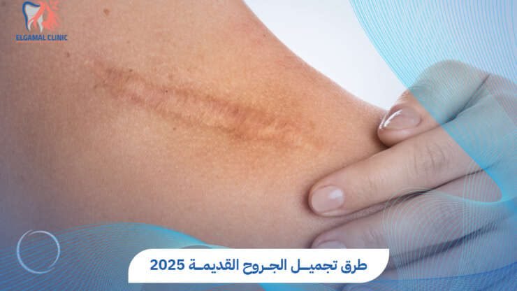 تجميل الجروح القديمة بتقنيات حديثة في عيادات الجمل