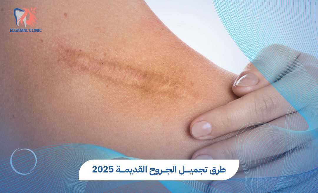 تجميل الجروح القديمة بتقنيات حديثة في عيادات الجمل
