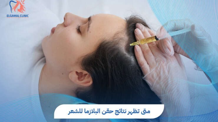 متى تظهر نتائج حقن البلازما للشعر؟ دليل شامل لاستعادة كثافة شعرك.