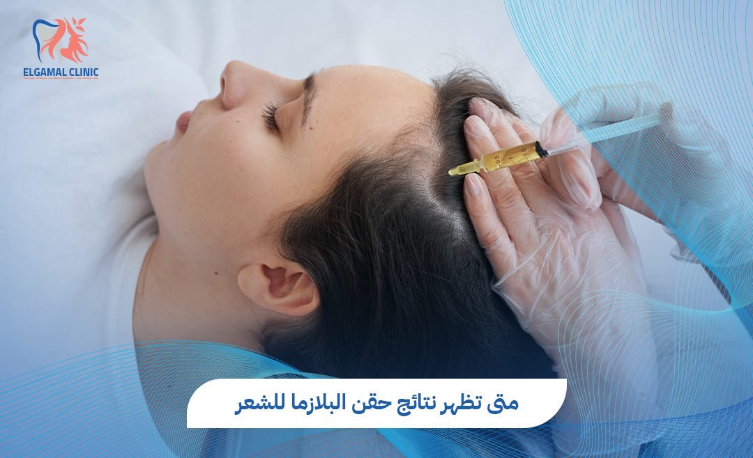 متى تظهر نتائج حقن البلازما للشعر؟ دليل شامل لاستعادة كثافة شعرك.