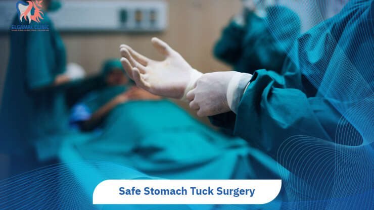 Stomach Tuck Surgery | Guide to Tummy Tuck in Egypt.