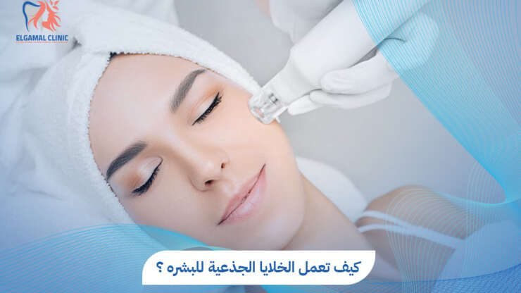 الخلايا الجذعية للبشرة: نتائج طبيعية خلال 3 جلسات | عيادات الجمل