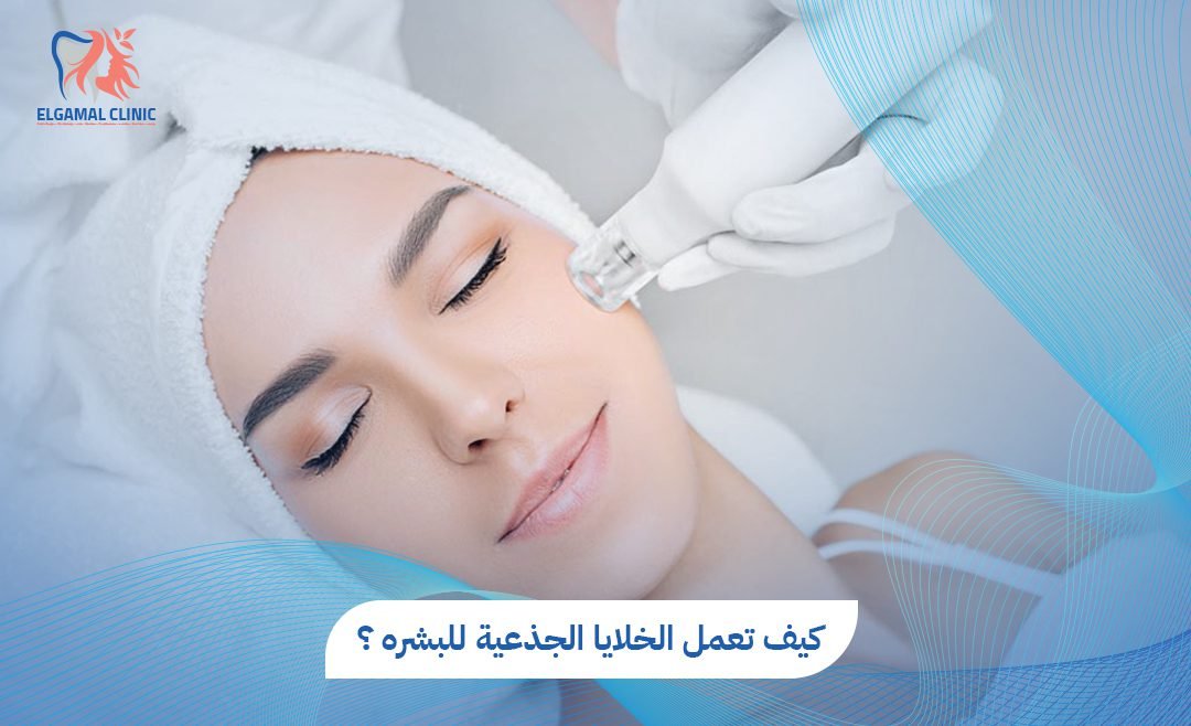 الخلايا الجذعية للبشرة: نتائج طبيعية خلال 3 جلسات | عيادات الجمل